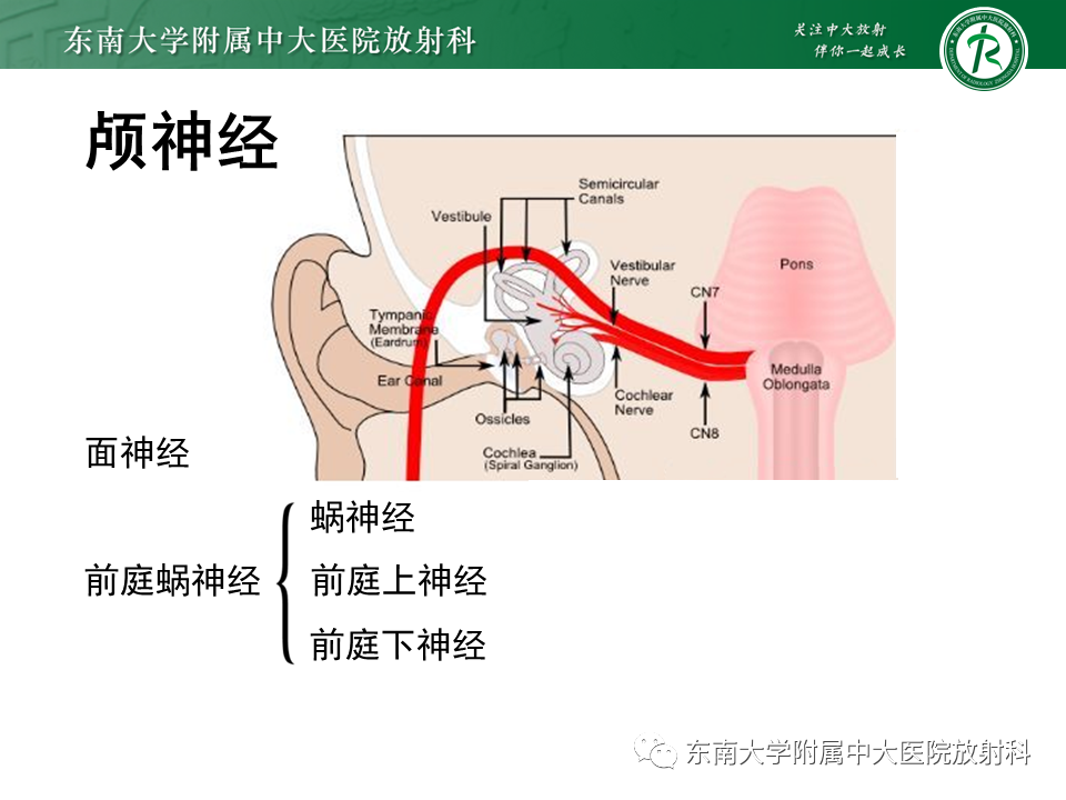 影像PPT - 【PPT】蜗神经发育不良-14 影像PPT - 【PPT】蜗神经发育不良-14