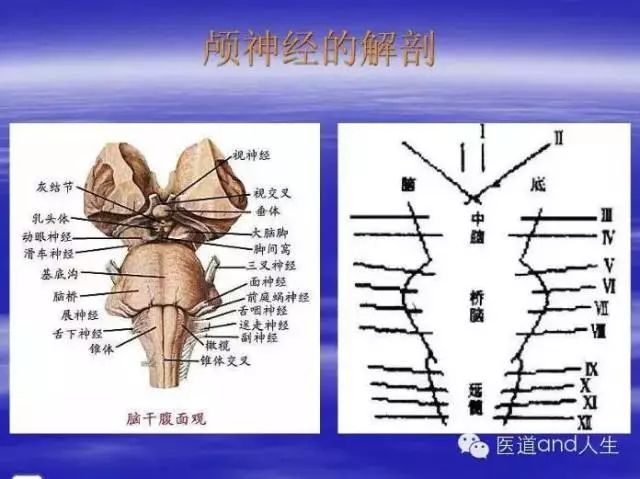 影像PPT - MRI图像中可以看到的八条颅神经-1 影像PPT - MRI图像中可以看到的八条颅神经-1