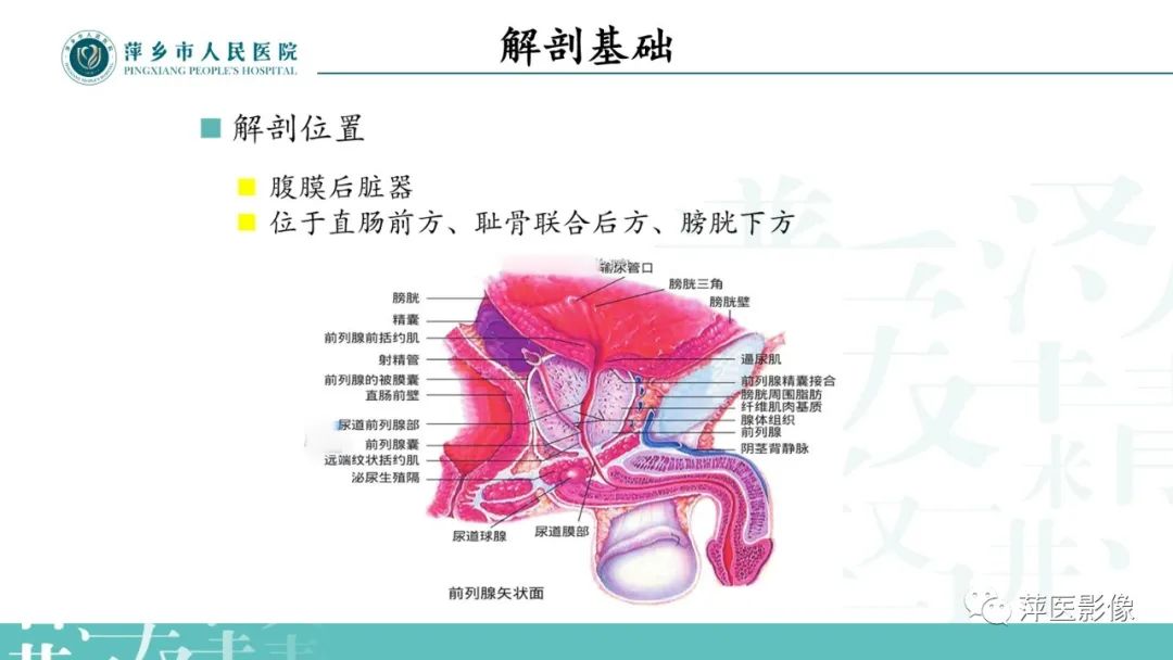 影像PPT - 【PPT】前列腺癌影像诊断-4