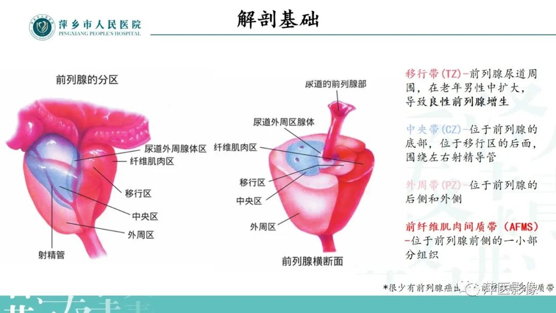 影像PPT - 【PPT】前列腺癌影像诊断-7