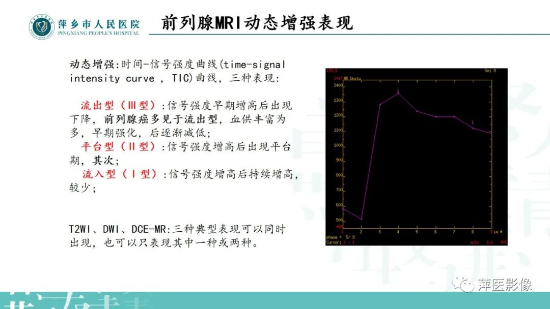 影像PPT - 【PPT】前列腺癌影像诊断-15