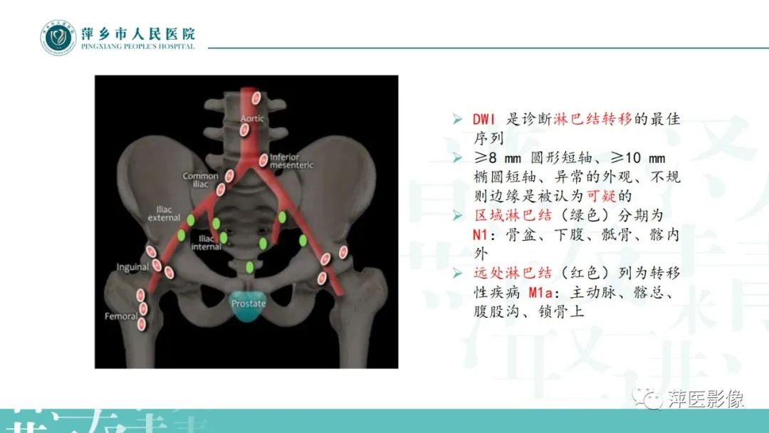 影像PPT - 【PPT】前列腺癌影像诊断-41