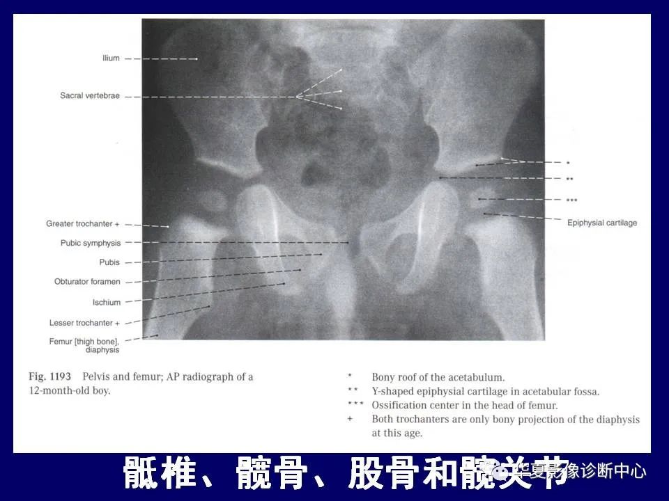 影像PPT - 【PPT】下肢的断层解剖-4