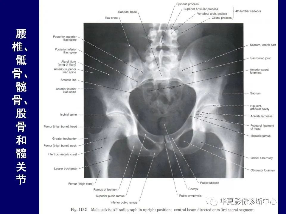 影像PPT - 【PPT】下肢的断层解剖-5