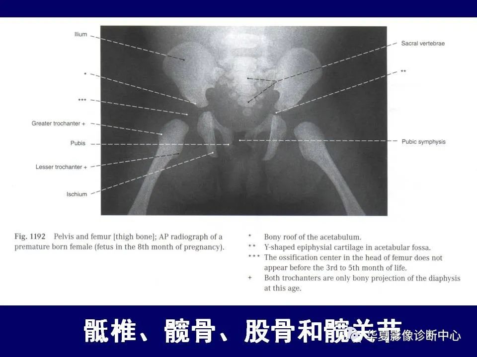影像PPT - 【PPT】下肢的断层解剖-3