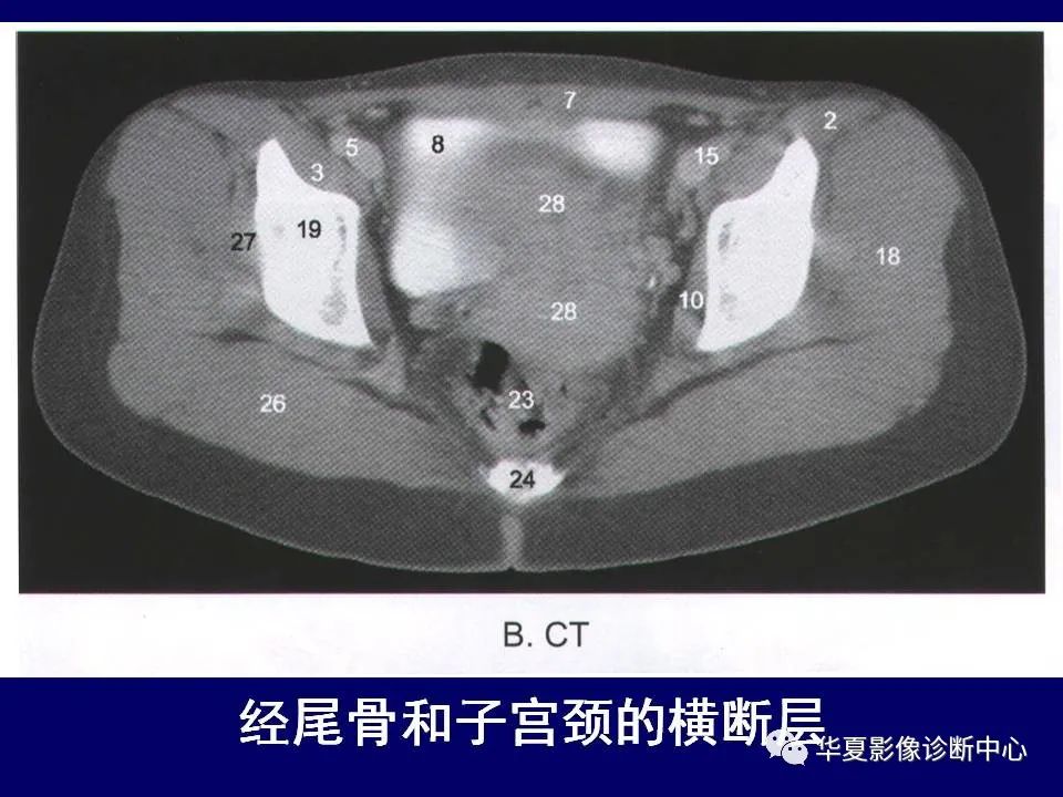 影像PPT - 【PPT】下肢的断层解剖-14