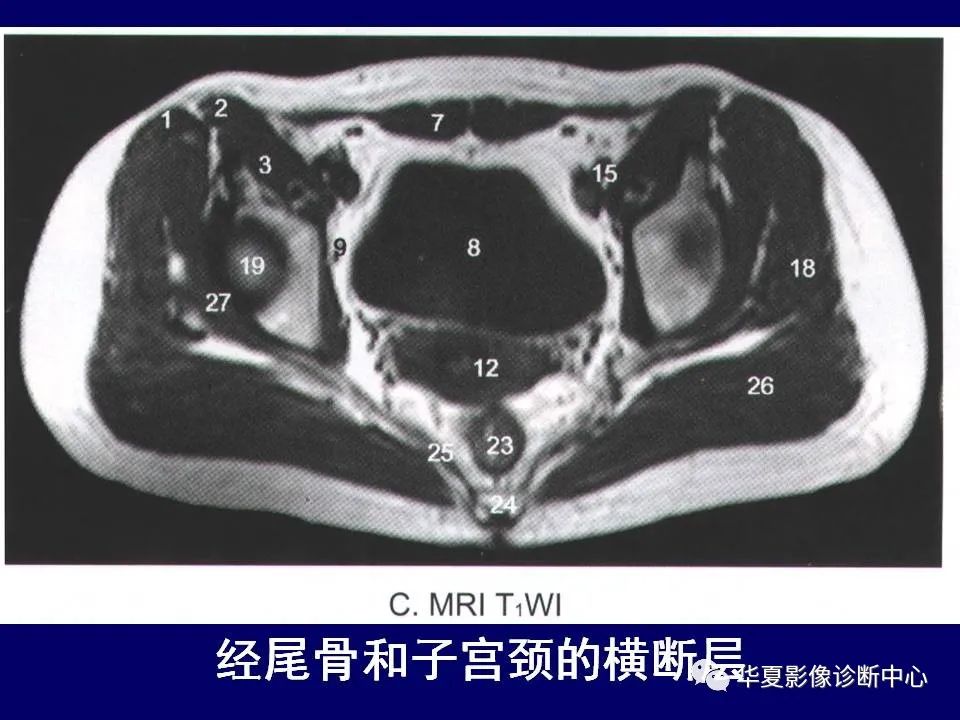 影像PPT - 【PPT】下肢的断层解剖-15