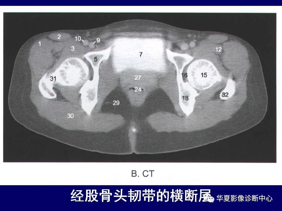 影像PPT - 【PPT】下肢的断层解剖-22