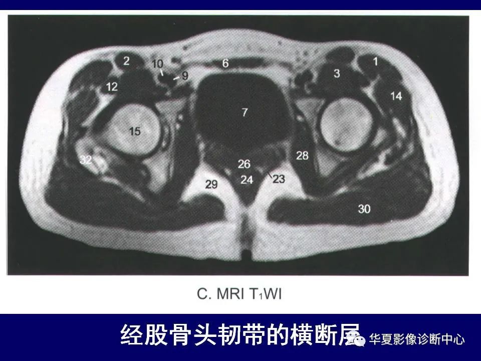 影像PPT - 【PPT】下肢的断层解剖-23