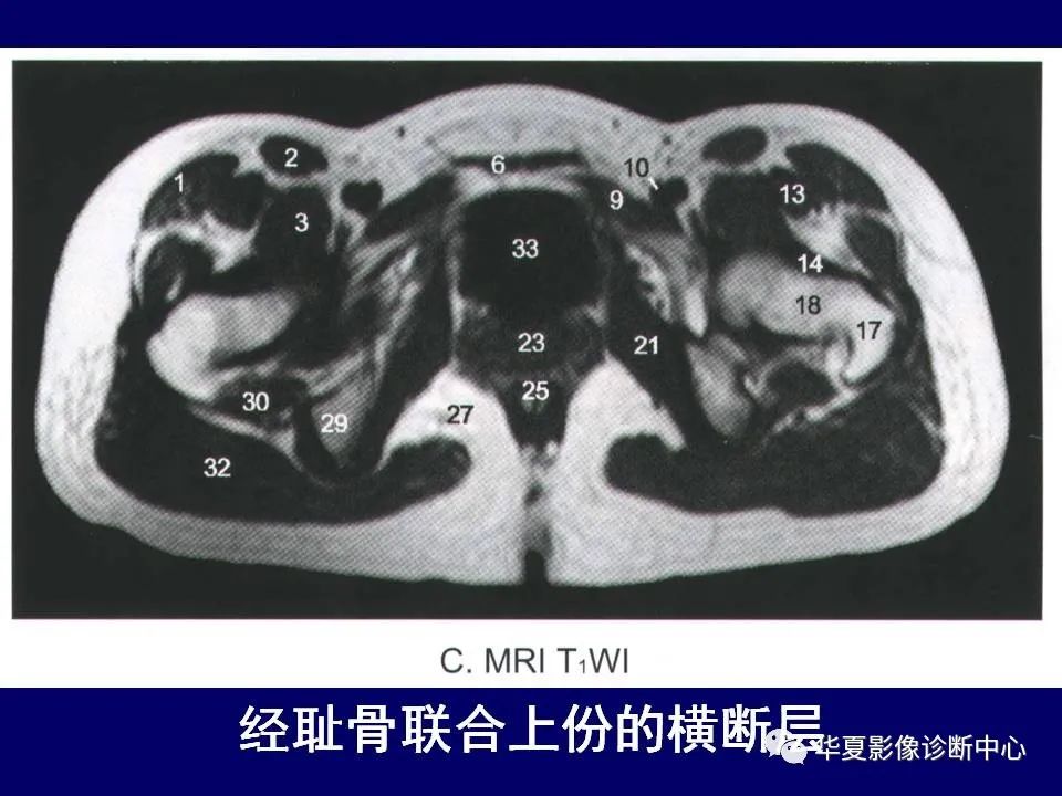 影像PPT - 【PPT】下肢的断层解剖-27