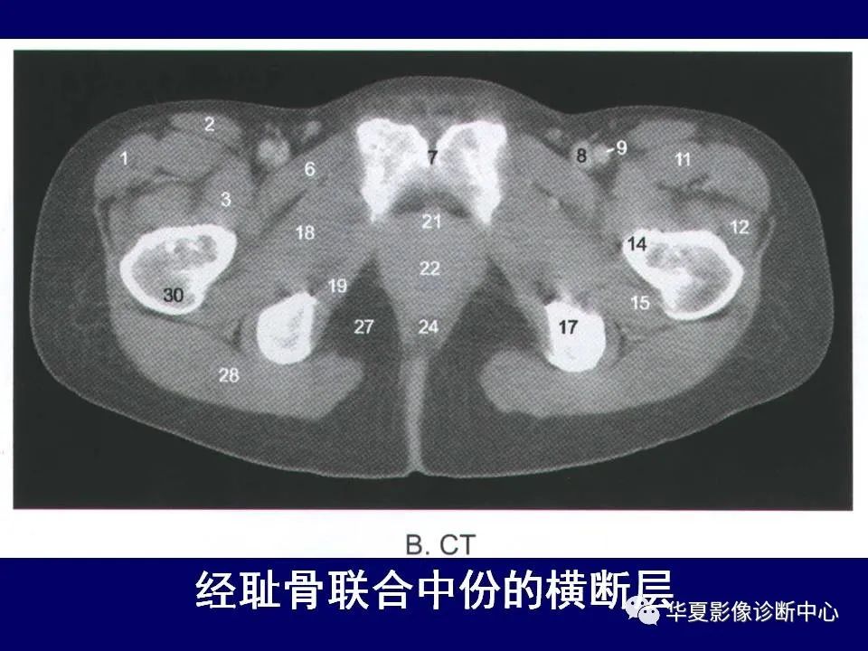 影像PPT - 【PPT】下肢的断层解剖-30