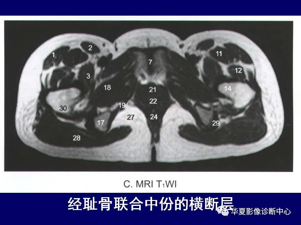 影像PPT - 【PPT】下肢的断层解剖-31