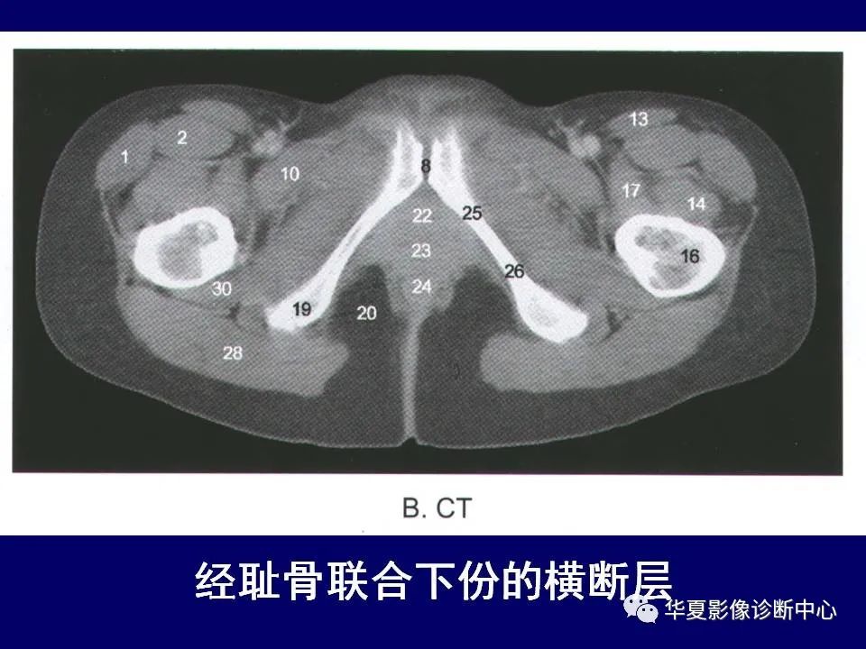 影像PPT - 【PPT】下肢的断层解剖-34