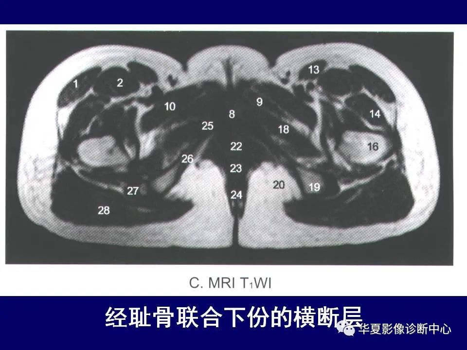 影像PPT - 【PPT】下肢的断层解剖-35