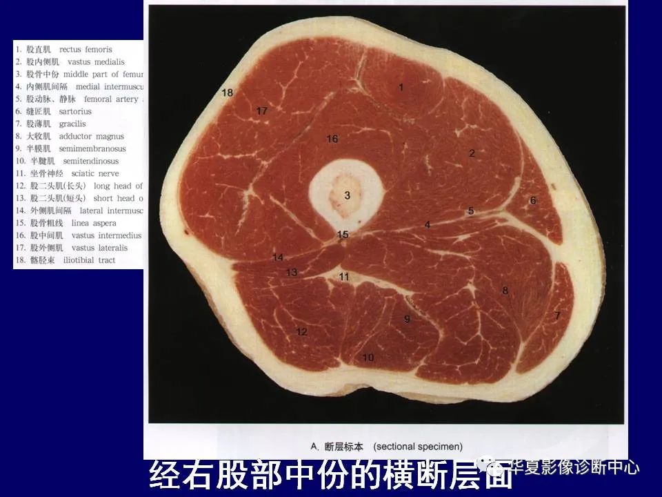 影像PPT - 【PPT】下肢的断层解剖-37