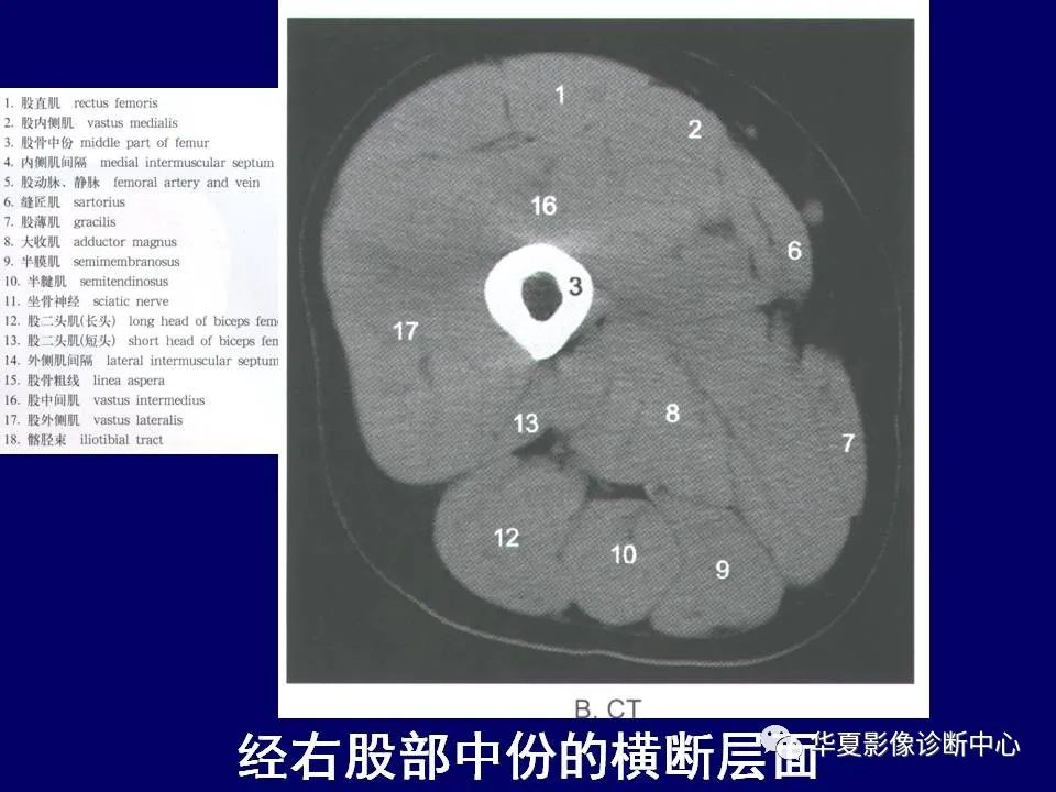 影像PPT - 【PPT】下肢的断层解剖-38