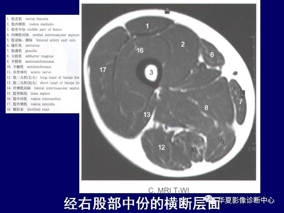 影像PPT - 【PPT】下肢的断层解剖-39