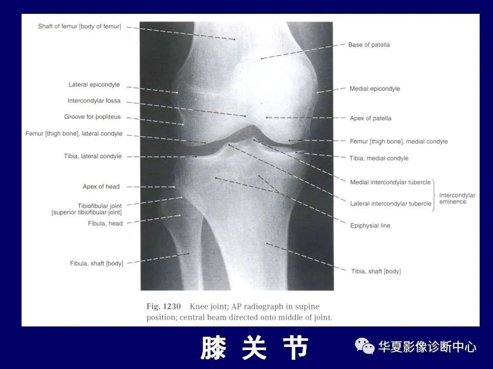 影像PPT - 【PPT】下肢的断层解剖-41