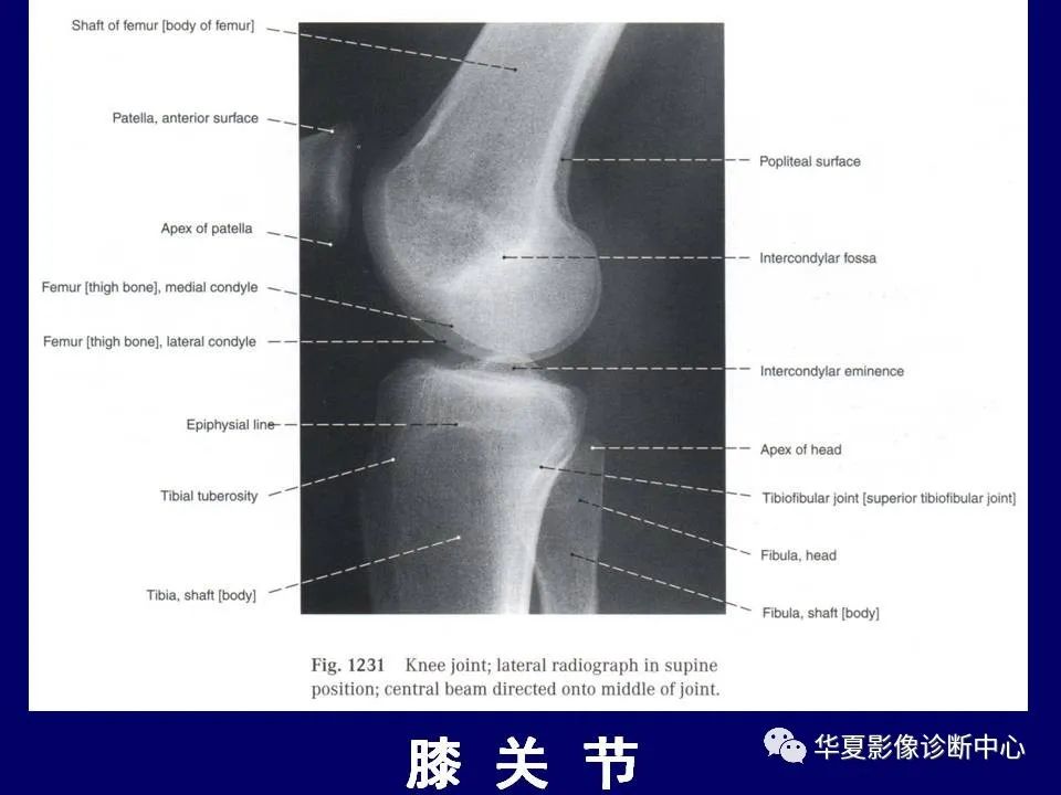 影像PPT - 【PPT】下肢的断层解剖-42