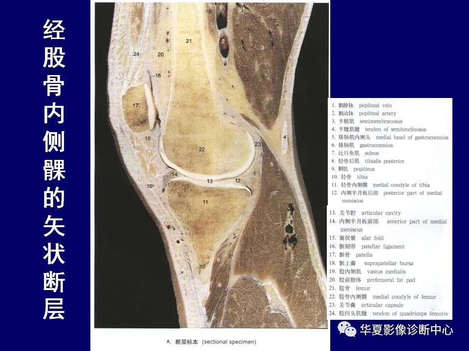 影像PPT - 【PPT】下肢的断层解剖-47