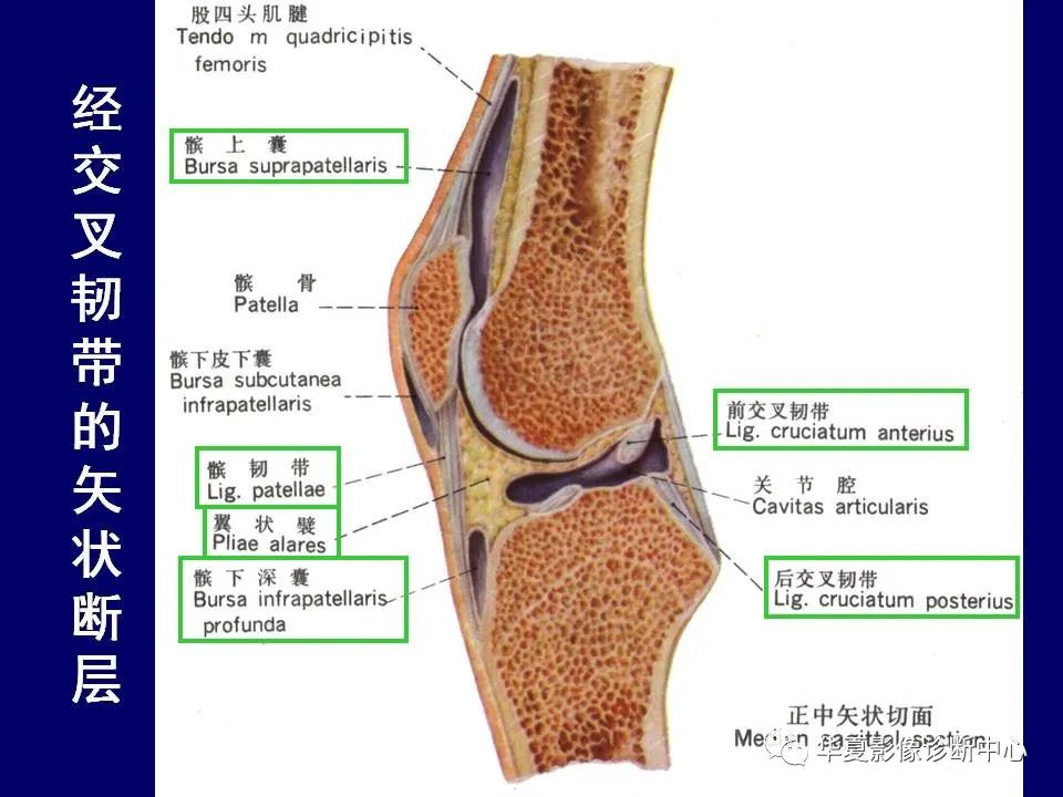 影像PPT - 【PPT】下肢的断层解剖-49