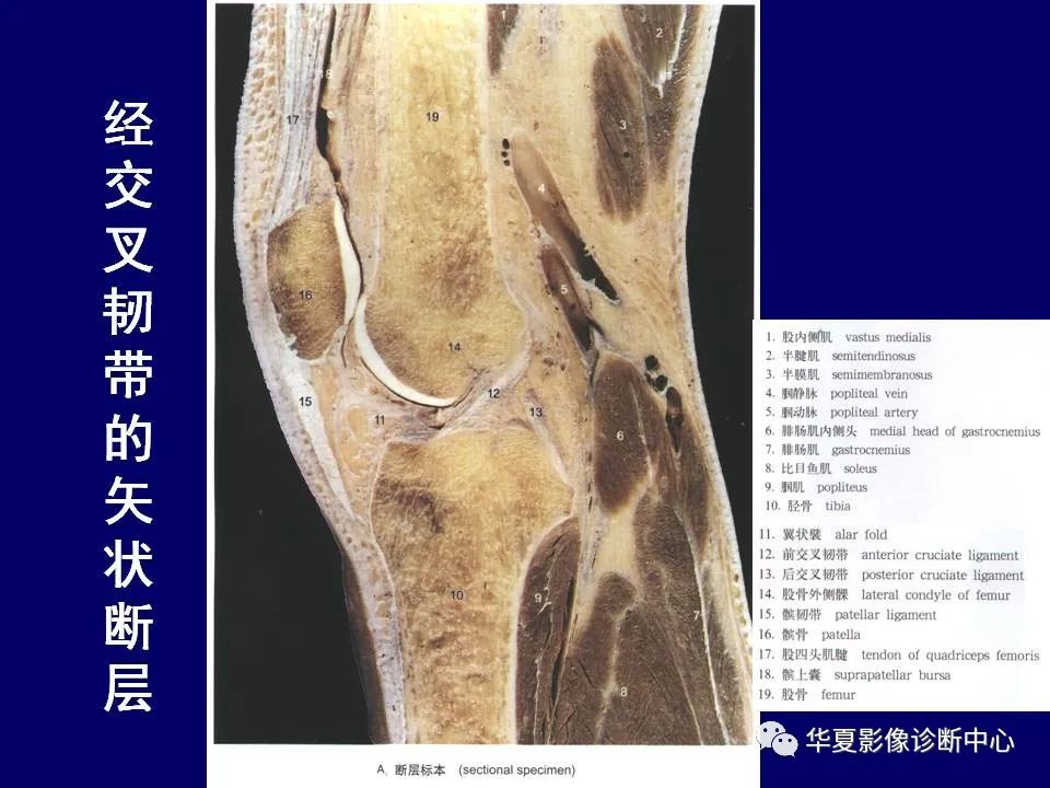 影像PPT - 【PPT】下肢的断层解剖-50