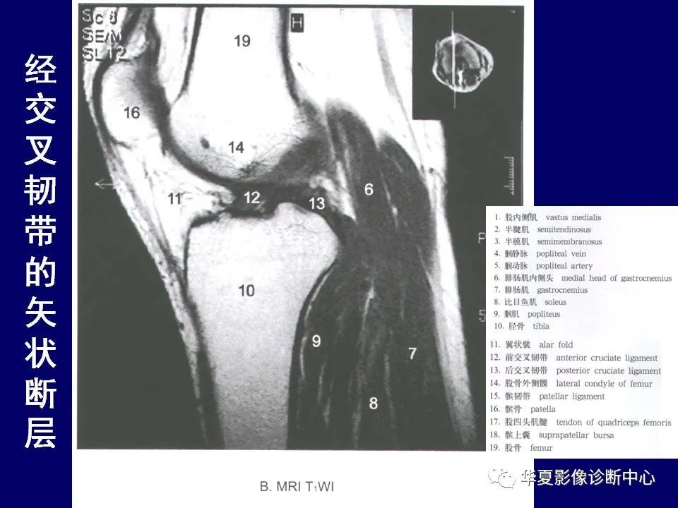 影像PPT - 【PPT】下肢的断层解剖-51