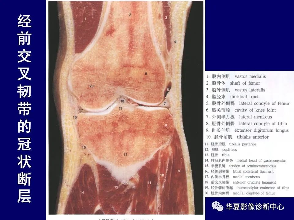 影像PPT - 【PPT】下肢的断层解剖-52