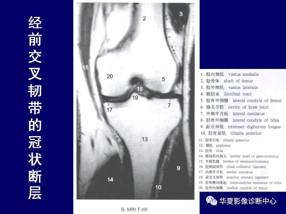 影像PPT - 【PPT】下肢的断层解剖-53