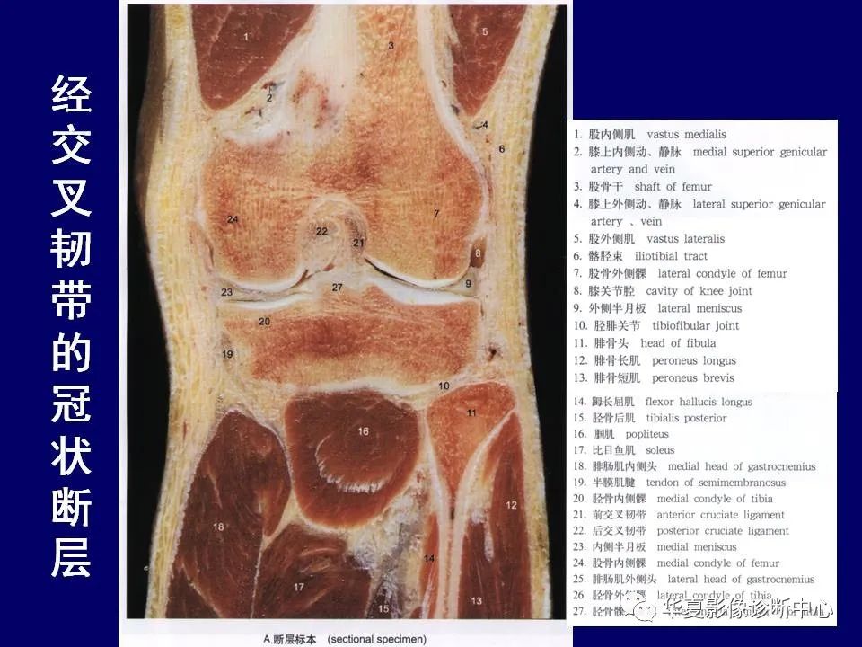 影像PPT - 【PPT】下肢的断层解剖-54