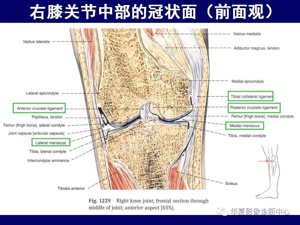 影像PPT - 【PPT】下肢的断层解剖-56