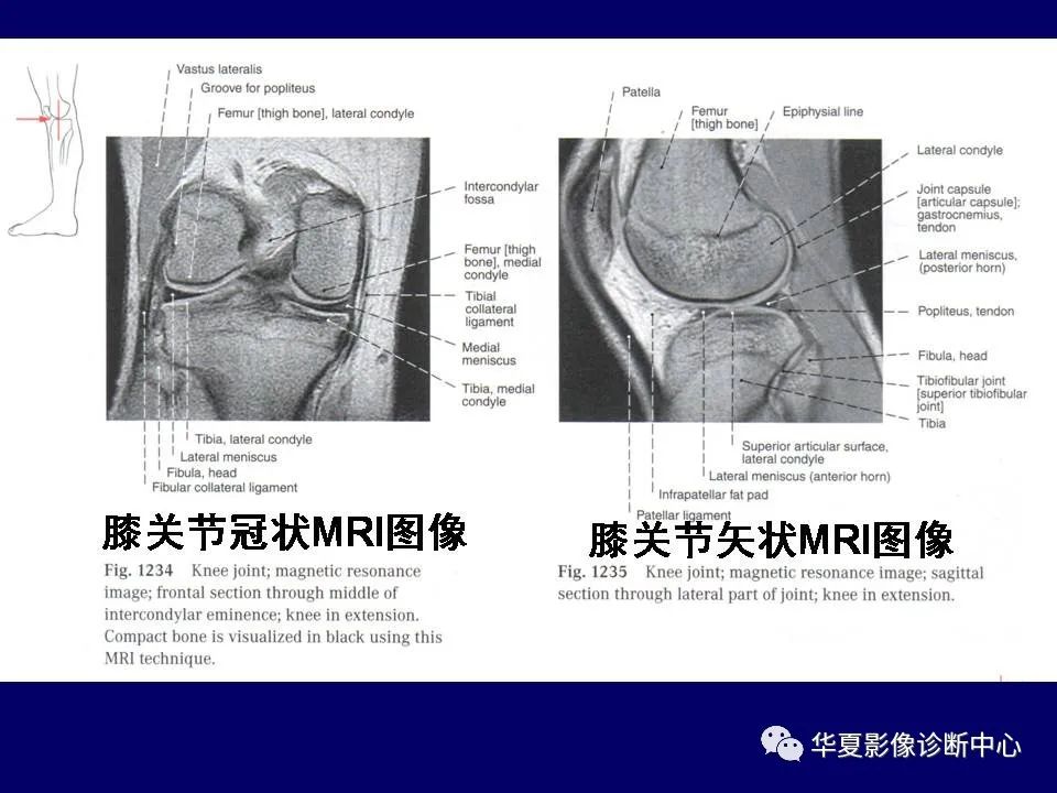 影像PPT - 【PPT】下肢的断层解剖-57