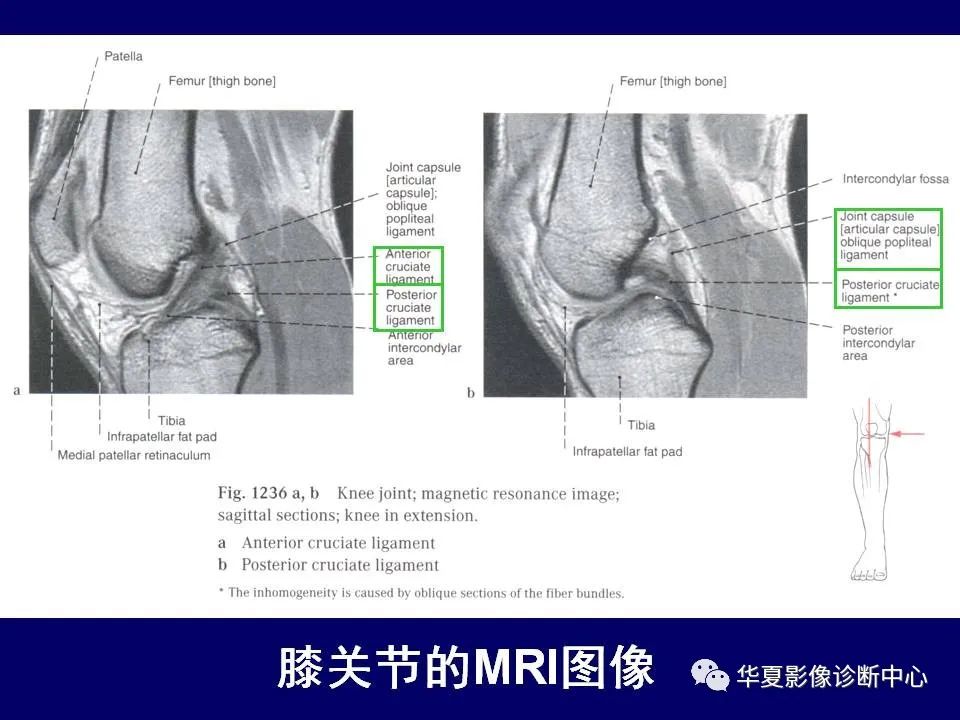 影像PPT - 【PPT】下肢的断层解剖-58