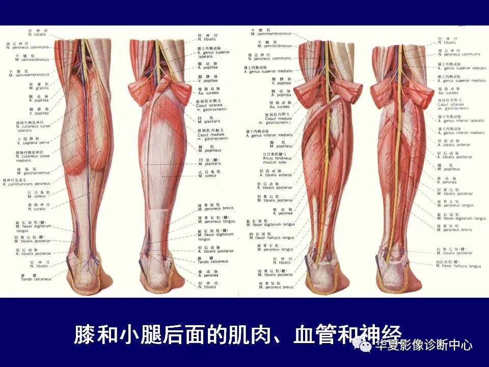 影像PPT - 【PPT】下肢的断层解剖-61