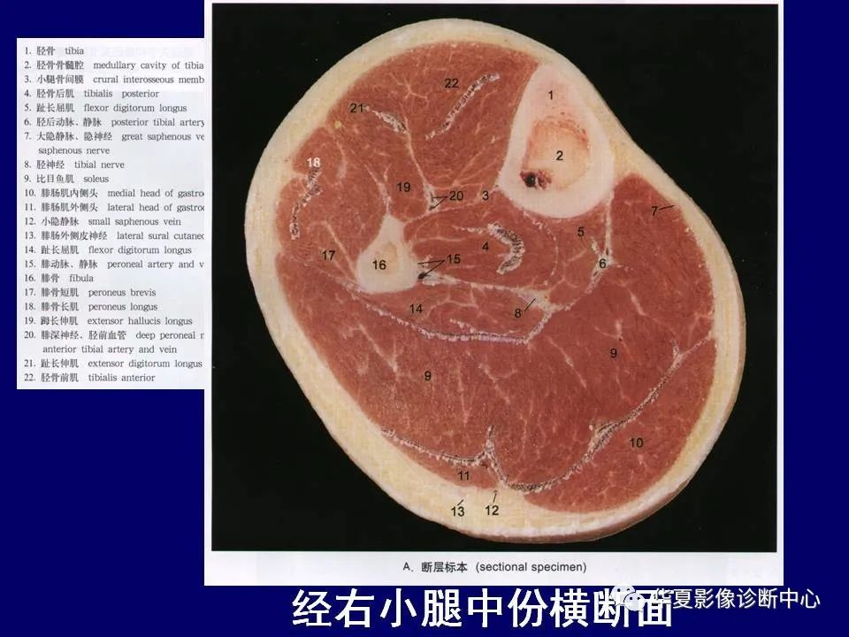影像PPT - 【PPT】下肢的断层解剖-62