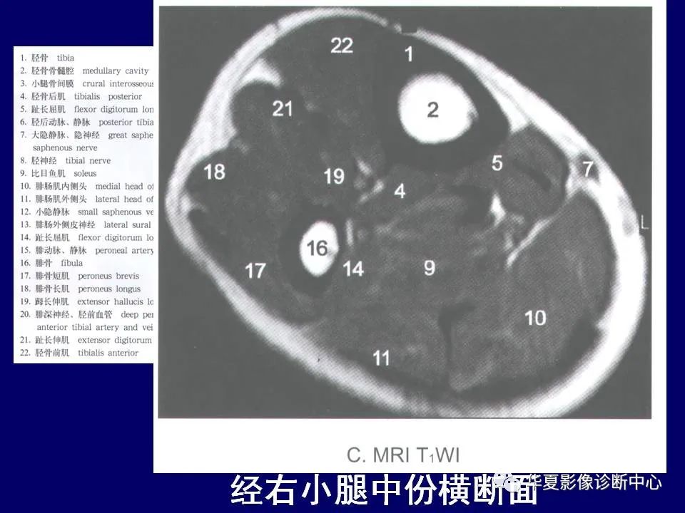 影像PPT - 【PPT】下肢的断层解剖-64