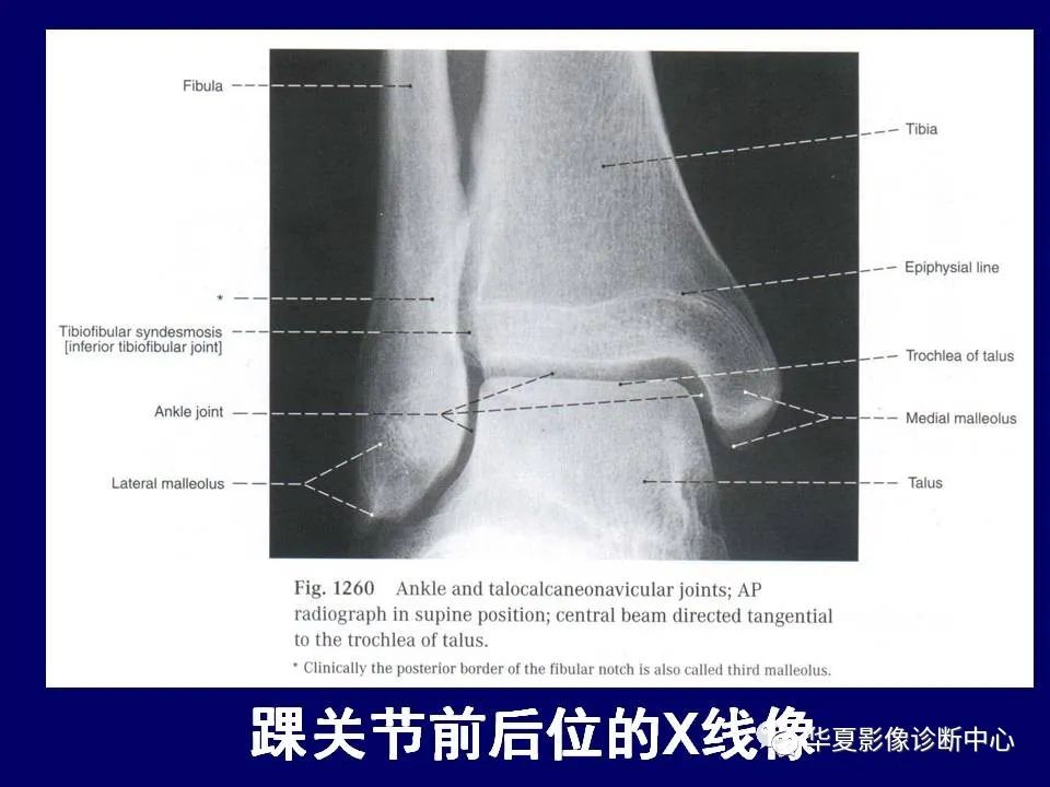 影像PPT - 【PPT】下肢的断层解剖-66
