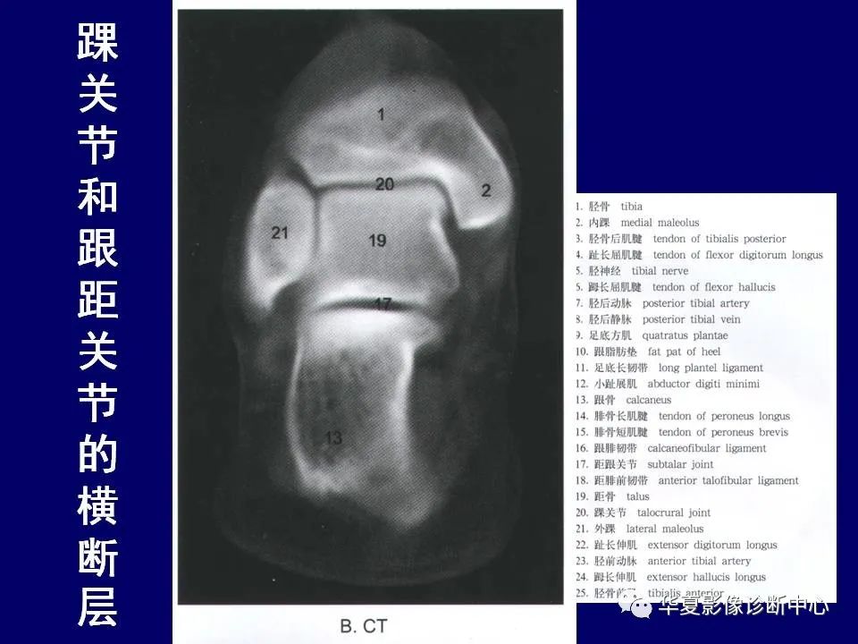 影像PPT - 【PPT】下肢的断层解剖-71