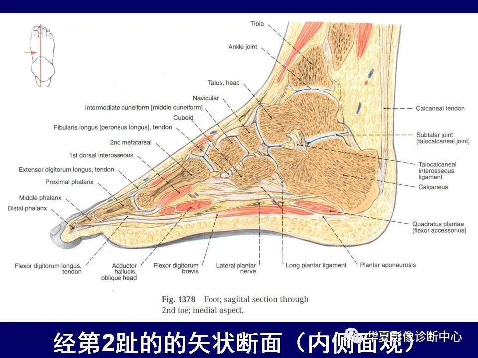 影像PPT - 【PPT】下肢的断层解剖-73