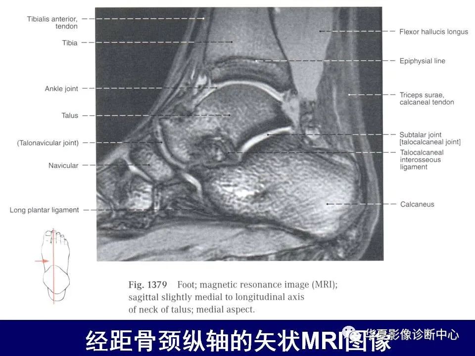 影像PPT - 【PPT】下肢的断层解剖-74
