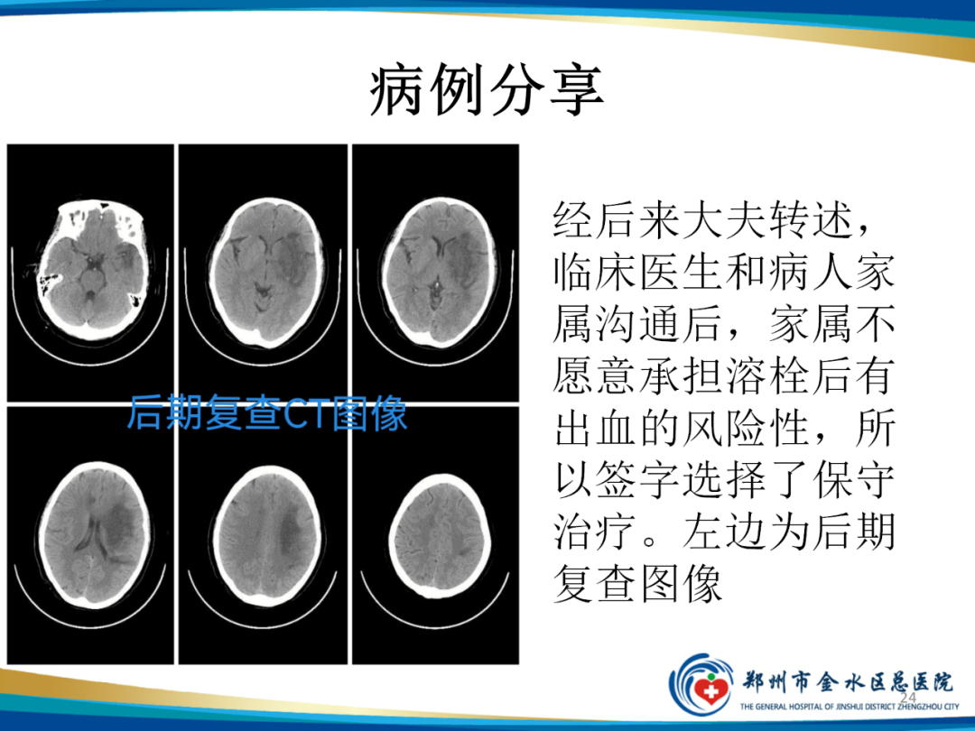 影像PPT - 【PPT】“中风”超时间窗的TA还有救么？-24