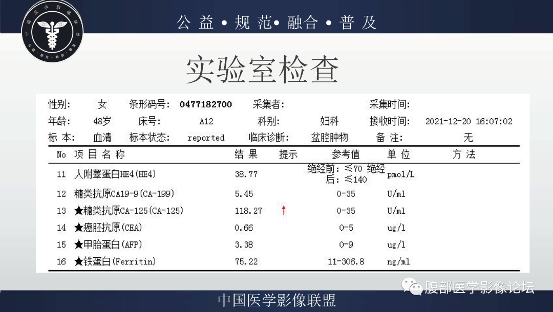 影像PPT - 【病例】卵巢弥漫大B细胞淋巴瘤1例MR影像-4