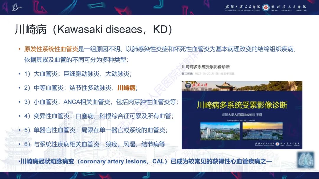 影像PPT - 【PPT】川崎病冠状动脉病变影像诊断-6
