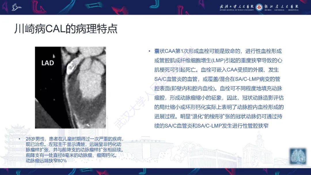 影像PPT - 【PPT】川崎病冠状动脉病变影像诊断-8