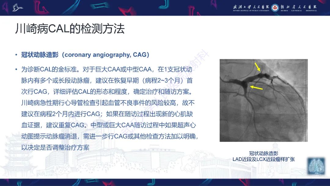 影像PPT - 【PPT】川崎病冠状动脉病变影像诊断-15