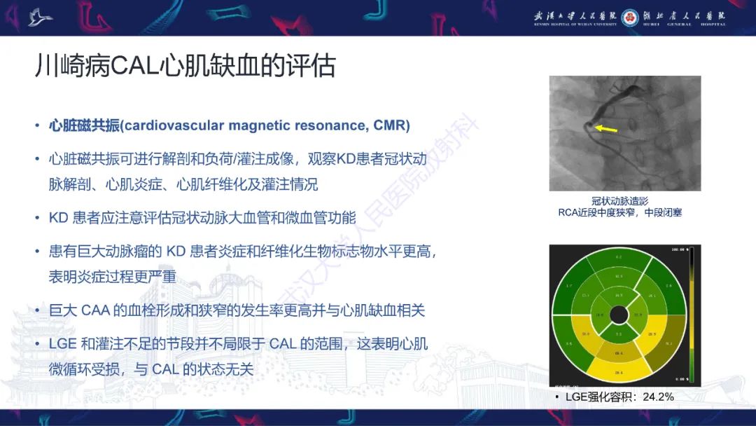 影像PPT - 【PPT】川崎病冠状动脉病变影像诊断-21