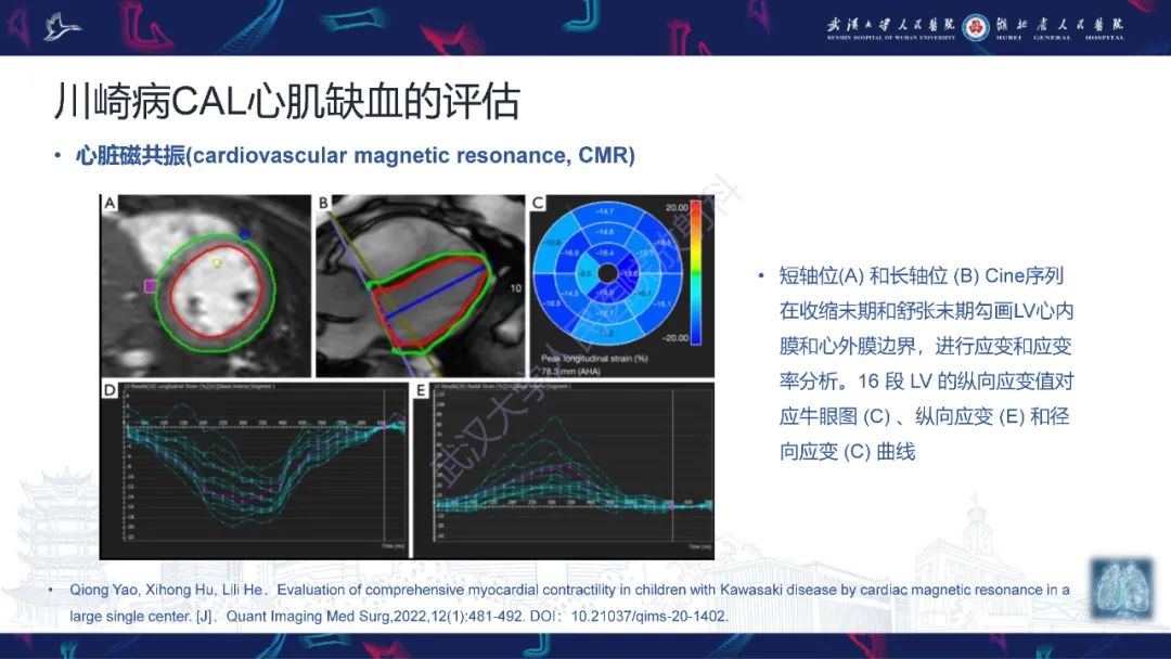 影像PPT - 【PPT】川崎病冠状动脉病变影像诊断-23