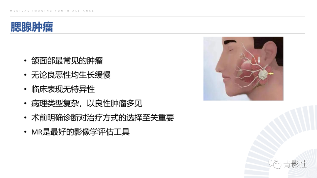 影像PPT - 【PPT】腮腺肿瘤的MRI诊断思路-5