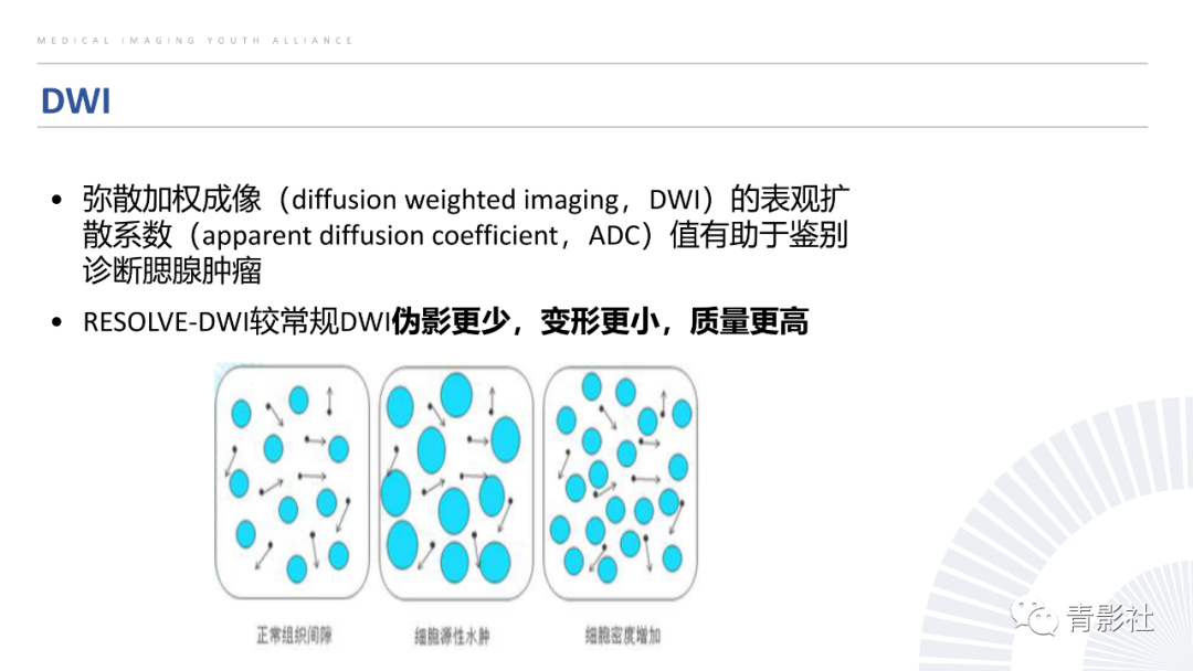 影像PPT - 【PPT】腮腺肿瘤的MRI诊断思路-10