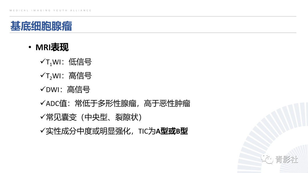 影像PPT - 【PPT】腮腺肿瘤的MRI诊断思路-21
